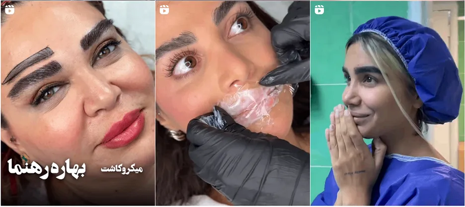 نمونه کار یکی از بروزترین کلینیک زیبایی در تهران را میتوانید در اینجا مشاهده بفرمایید.