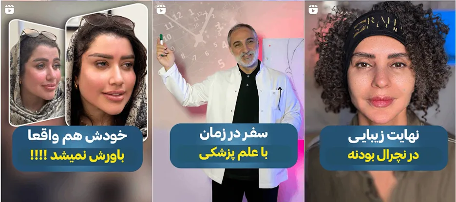 نمونه کار یکی دیگر از بهترین کلینیک زیبایی تهران را مشاهده میفرمایید.