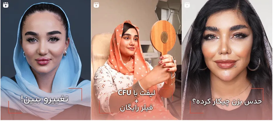 نمونه کار یکی از بهترین کلینیک زیبایی در تهران را مشاهده میفرمایید.