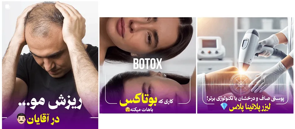 نمونه کار یکی از بهترین کلینیک زیبایی کرمان را مشاهده میفرمایید.