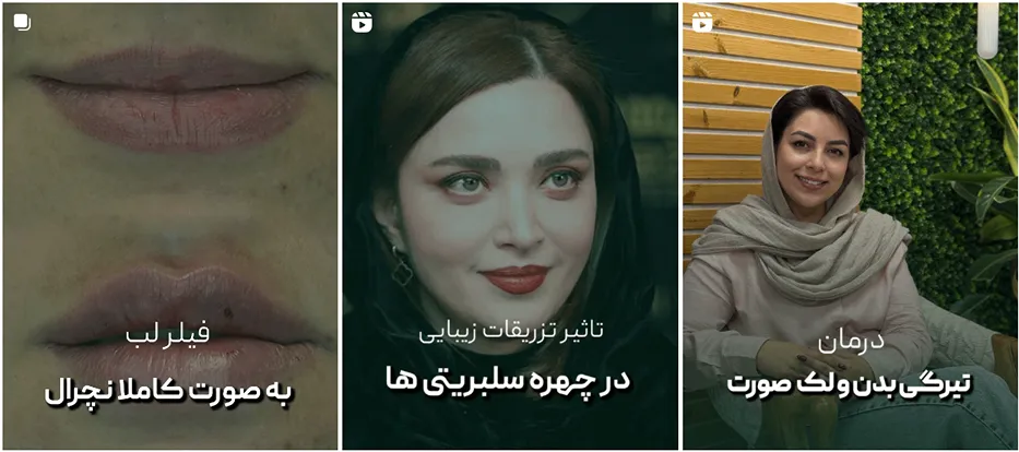 نمونه کار کلینیک دکتر اردکانی از بهترین کلینیک زیبایی اراک را مشاهده میفرمایید.