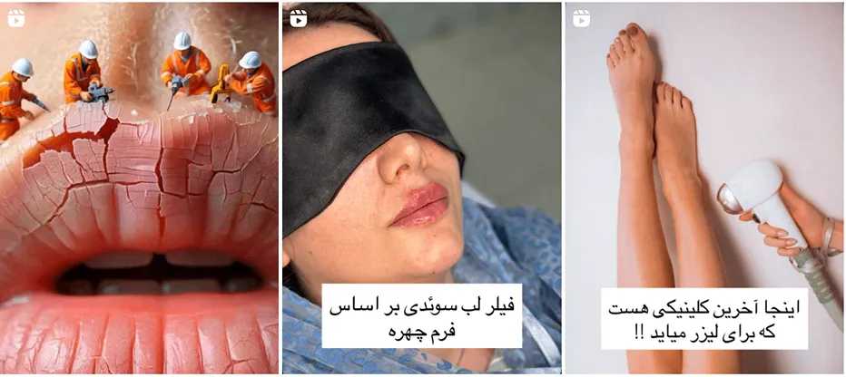 نمونه کار کلینیک ارغوان از بهترین کلینیک زیبایی در ارومیه را مشاهده میفرمایید.