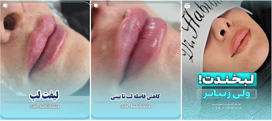 نمونه کار بهترین کلینیک زیبایی کرمان را مشاهده میفرمایید.