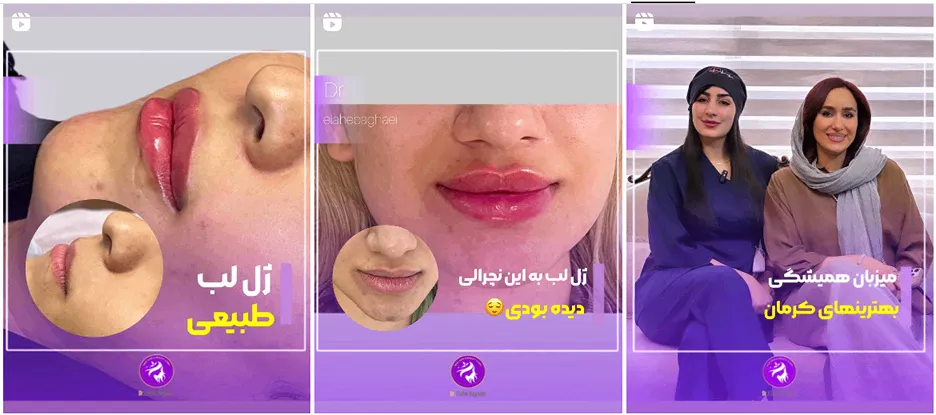 نمونه کار کلینیک زیبایی کرمان را مشاهده میفرمایید.
