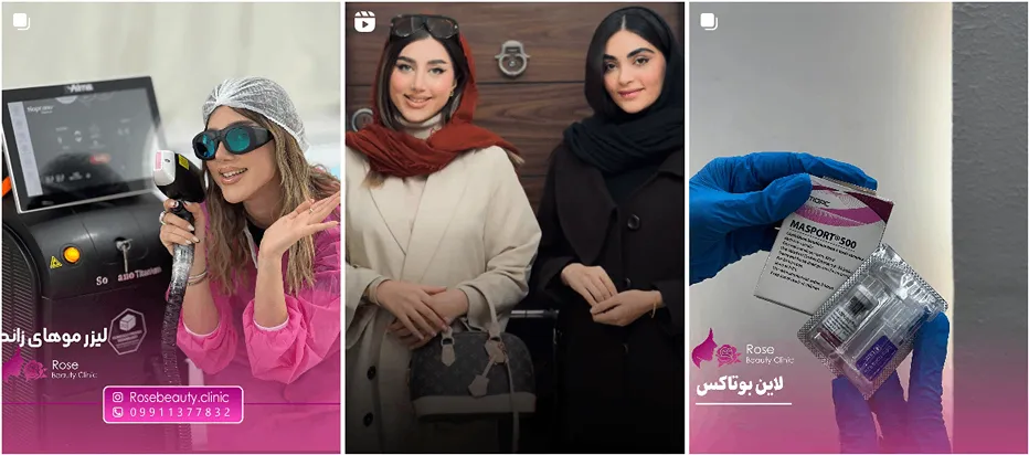 نمونه کار یکی از بهترین کلینیک زیبایی بوشهر را مشاهده میفرمایید.