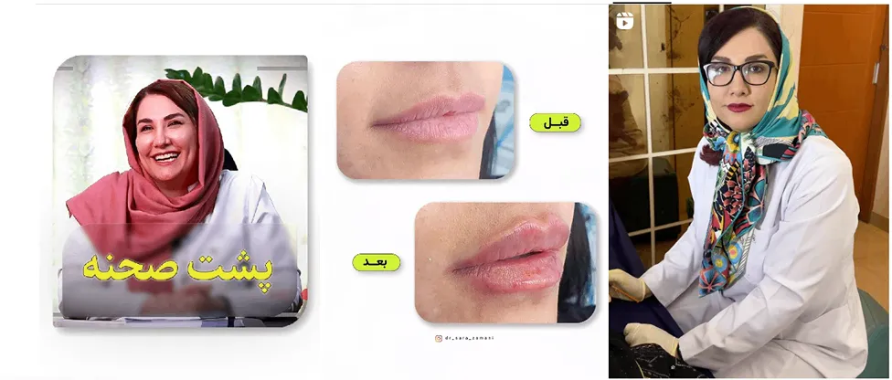 نمونه کار دکتر زمانی از بهترین دارنده های کلینیک زیبایی در ارومیه را مشاهده میفرمایید.