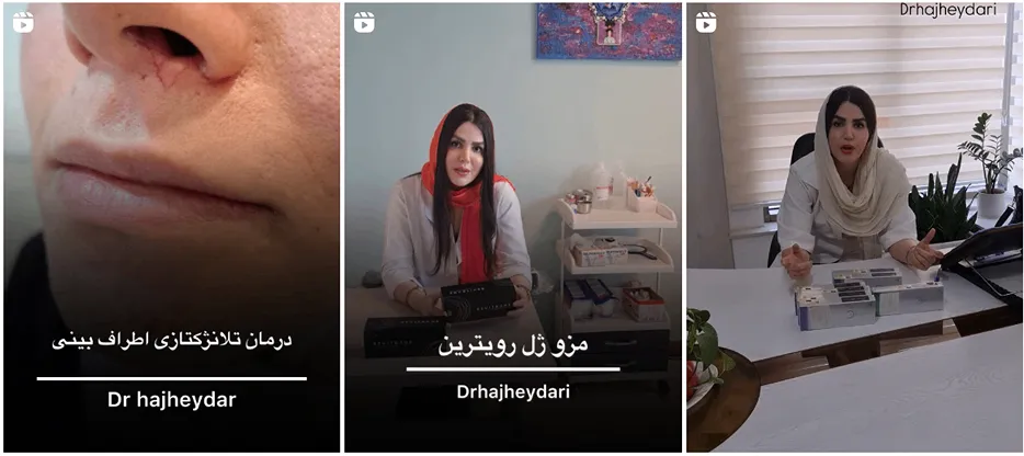 نمونه کار کلینیک صدف از جمله کلینیک های خوب در ساری است