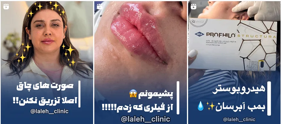 تصاویری از بهترین نمونهک ارهای یکی از بهترین کلینیک زیبایی در ارومیه را مشاهده میفرمایید.