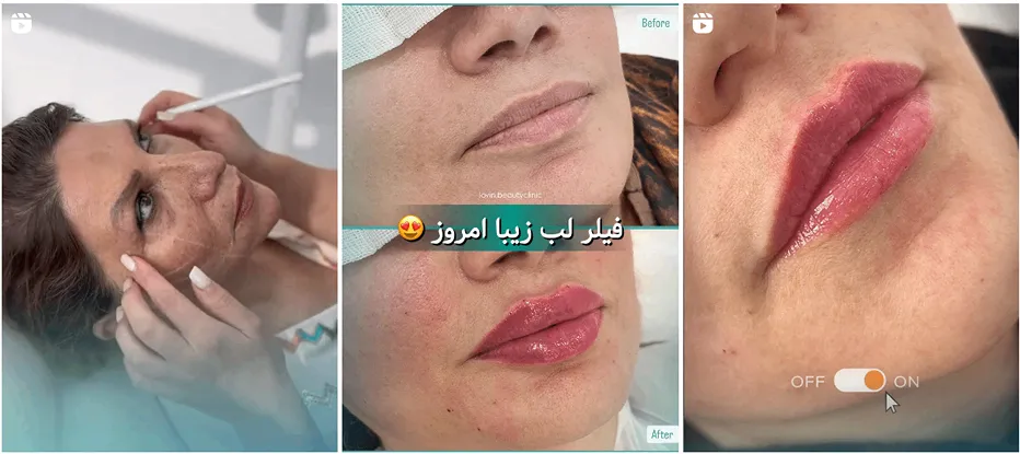 نمونه کار بهترین کلینیک زیبایی اراک را مشاهده میفرمایید.