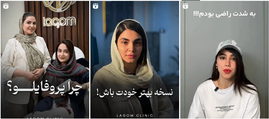 تصویری از نمونه کار کلینیک زیبایی لاگوم را مشاهده بفرمایید.