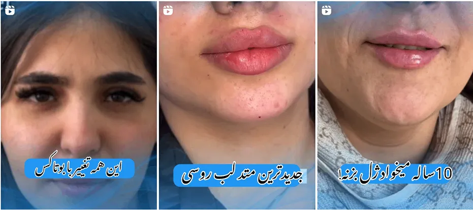 تصویر و نمونه کار یکی از بهترین کلینیک زیبایی در اراک را مشاهده میفرمایید.