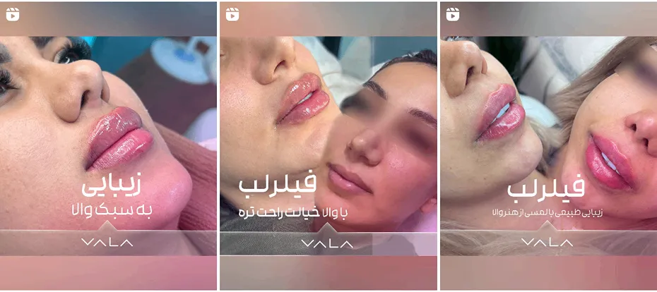 نمونه کار بهترین کلینیک زیبایی کرمان را مشاهده میفرمایید.