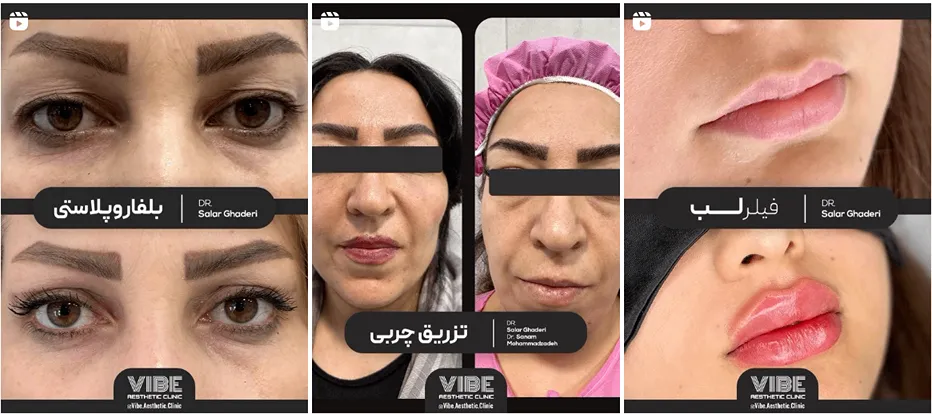 نمونه کار یکی از بهترین کلینیک زیبایی ارومیه را مشاهده میفرمایید.