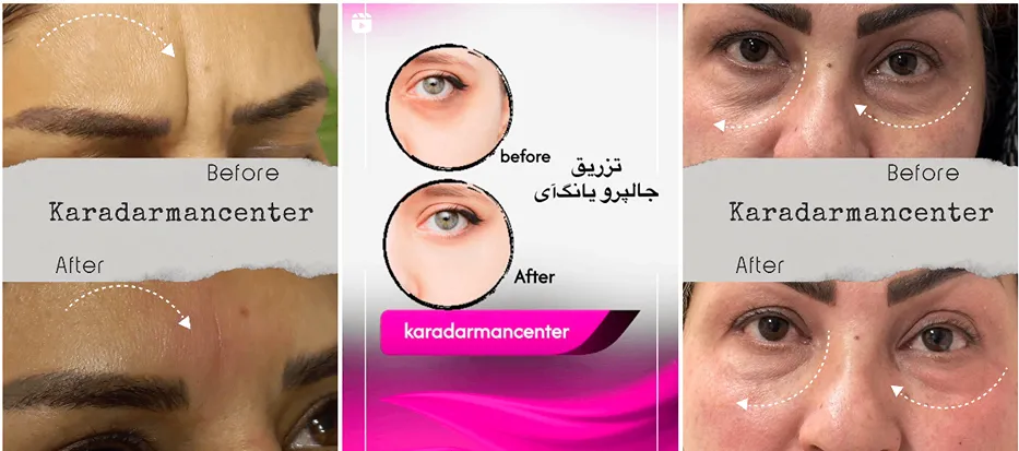 نمونه کار بهترین کلینیک زیبایی کرمان را مشاهده میفرمایید.