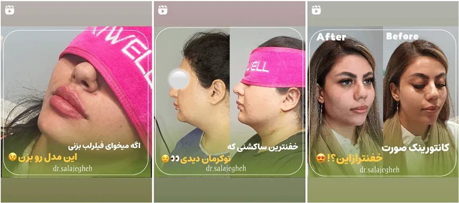 نمونه کار یکی از بهترین کلینیک زیبایی در کرمان را مشاهده میفرمایید.