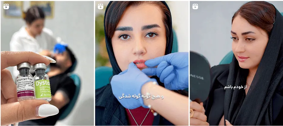 کلینیک زیبایی گرین از بهترین کلینیک زیبایی در کرمان است