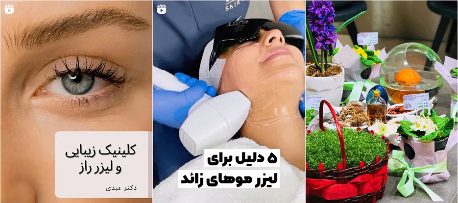 نمونه کار یکی از بهترین مرکز لیزر در اراک را مشاهده میفرمایید.