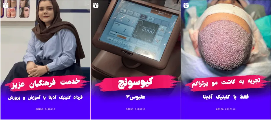 نمونه کار یکی از برترین مراکز لیزر در قم را مشاهده میفرمایید.