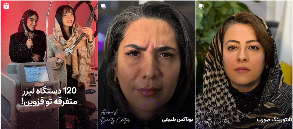 نمونه کار یکی از بهترین مراکز لیزر در قزوین را مشاهده میفرمایید.