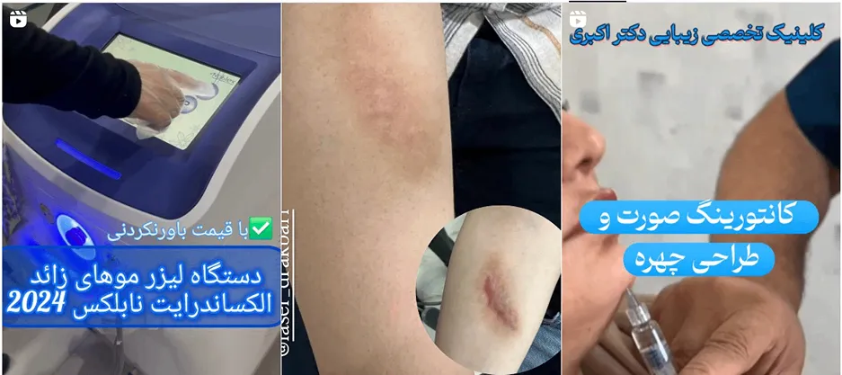 نمونه کار یکی از مدرن ترین مراکز لیزر در ارومیه را مشاهده میفرمایید