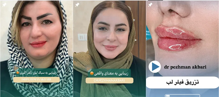 نمونه کار یکی از بروزترین کلینیک زیبایی یاسوج را مشاهده میفرمایید.