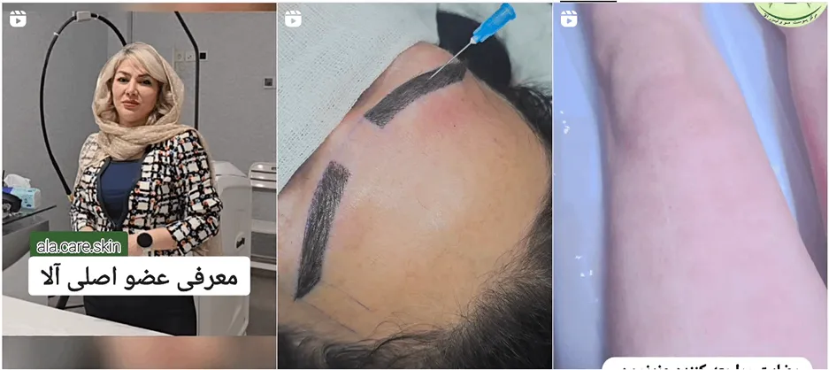 نمونه کار کلینیک زیبایی الا را در این تصویر میتوانید مشاهده بفرمایید.