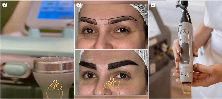 کلینیک زیبایی آلما از مجهزترین کلینیک لیزر در تبریز است