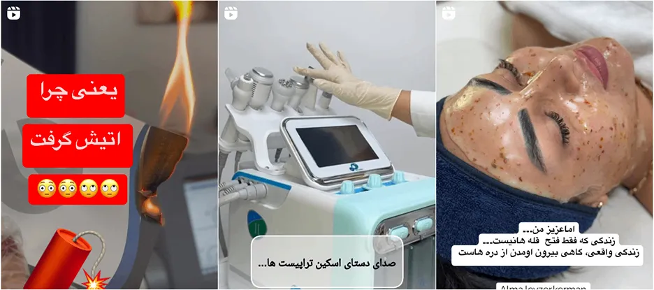 لیزر در کرمان در کلینیک آلما کاملا قابل انجام است