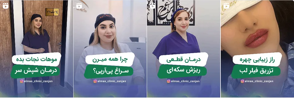 نمونه کار یکی از بهترین کلینیک زیبایی زنجان را مشاهده میفرمایید.