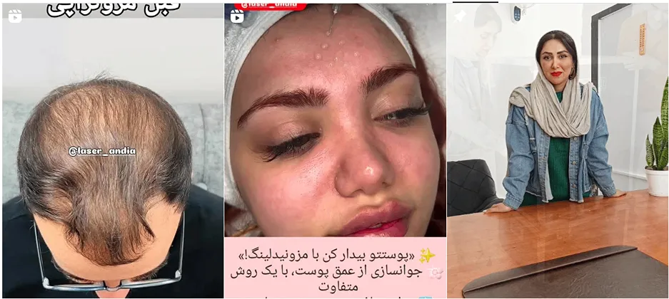 نمونه کار یکی دیگر از بهترین کلینیک زیبایی بیرجند را مشاهده میفرمایید.