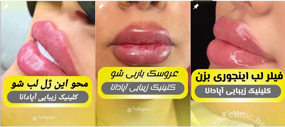 نمونه کار یکی از بهترین کلینیک زیبایی خرم آباد را مشاهده میفرمایید.