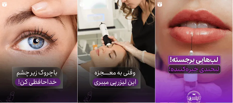 نمونه کار یکی از بهترین کلینیک لیزر در کرج را مشاهده میفرمایید.