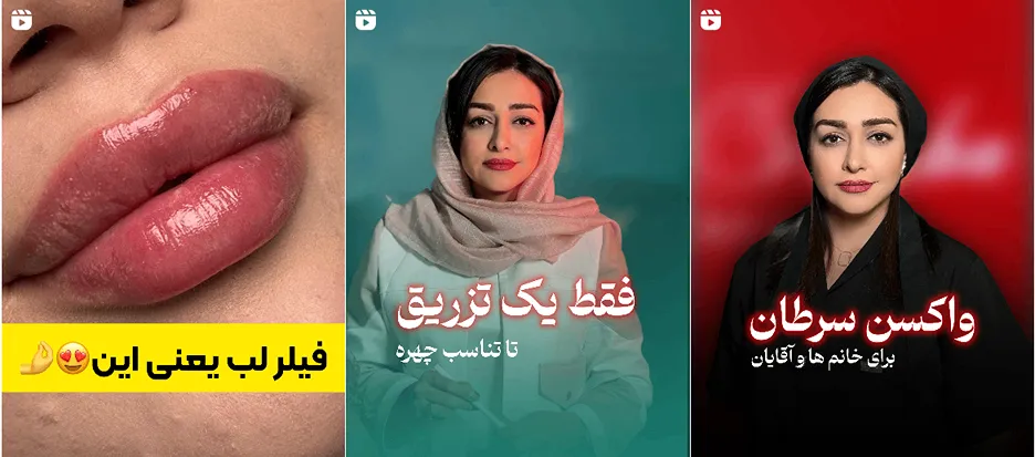 نمونه کار کلینیک زیبایی دکتر اقبالی را در این تصویر مشاهده میفرمایید.