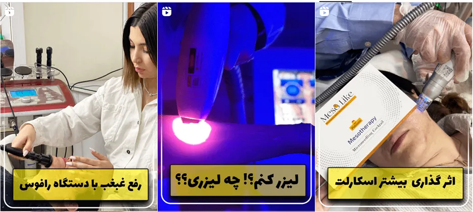 نمونه کار یکی از مدرن ترین کلینیک زیبایی در بجنورد را مشاهده میفرمایید.