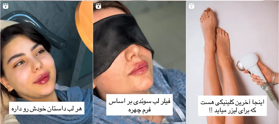 لیزر ارومیه در کلنییک زیبایی ارغوان کاملا قابل انجام است