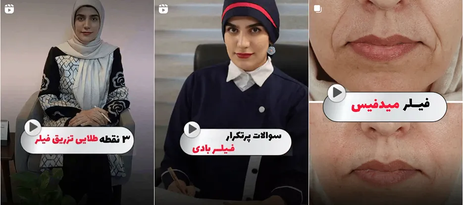 نمونه کار دکتر اسدپور را در این تصویر میتوانید مشاهده بفرمایید.