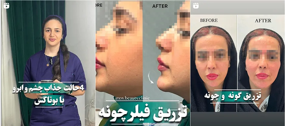 نمونه کار کلینیک زیبایی اتن را در این تصویر میتوانید مشاهده بفرمایید.
