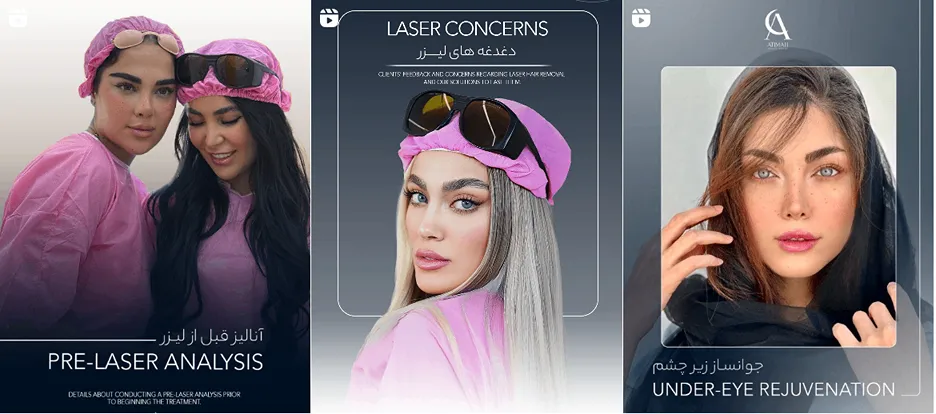 لیزر در تهران در کلینیک زیبایی آتی ماه کاملا قابل انجام است