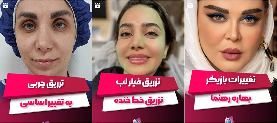 نمونه کار کلینیک اوینا را در این تصویر میتوانید مشاهده فرمایید.