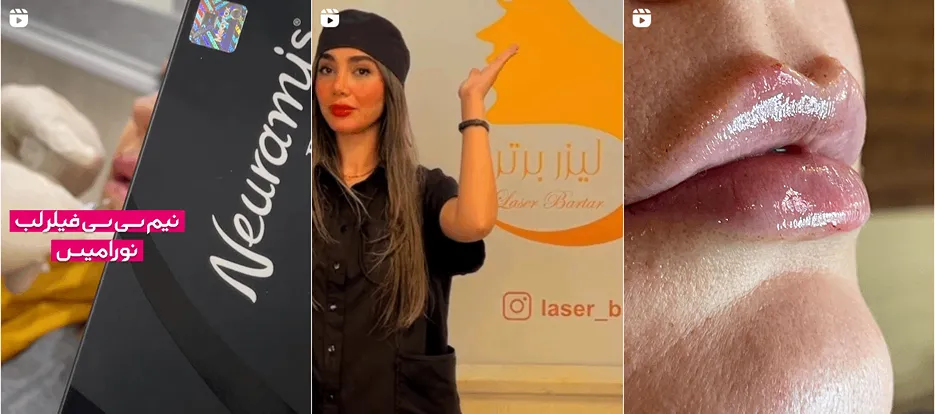 لیزر در قزوین در کلینیک زیبایی برتر کاملا قابل انجام است
