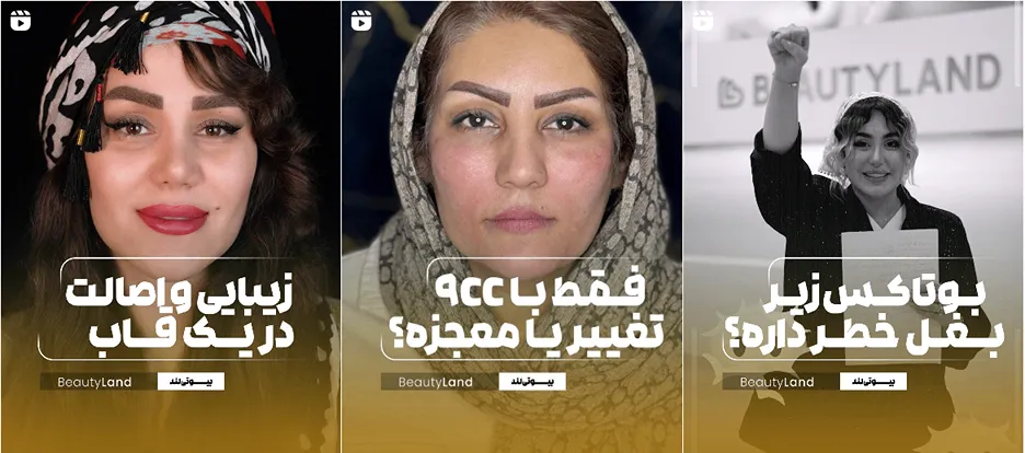 کلینیک زیبایی بیوتی لند از جمله مدرنترین کلینیک زیبایی در ایلام است