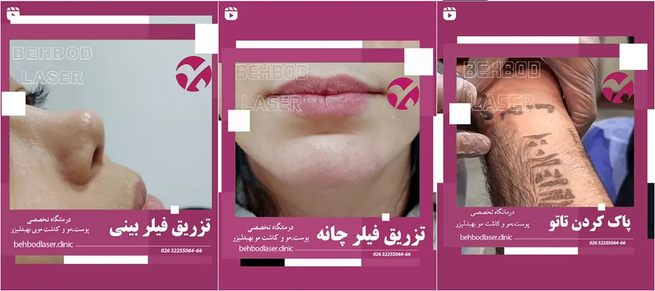 نمونه کار یکی از مجهزترین کلینیک لیزر کرج را مشاهده میفرمایید.