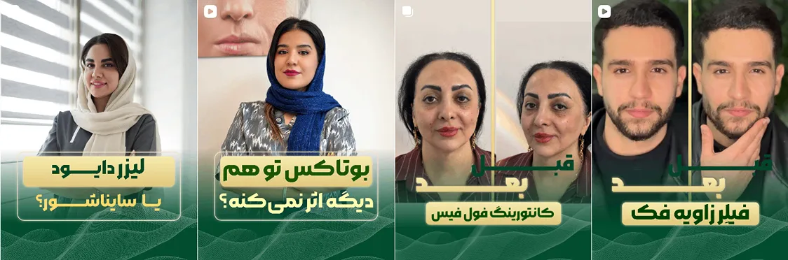 لیزر در کرج در کلینیک زیبایی بلا کاملا قابل انجام است