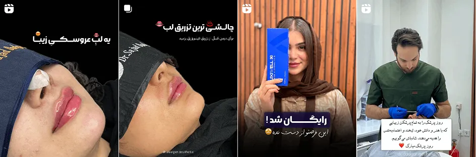 نمونه کار یکی از بهترین کلینیک زیبایی در یاسوج را میتوانید مشاهده بفرمایید.