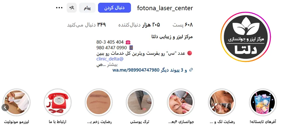 لیزر در تهران در کلینیک دلتا کاملا قابل انجام است