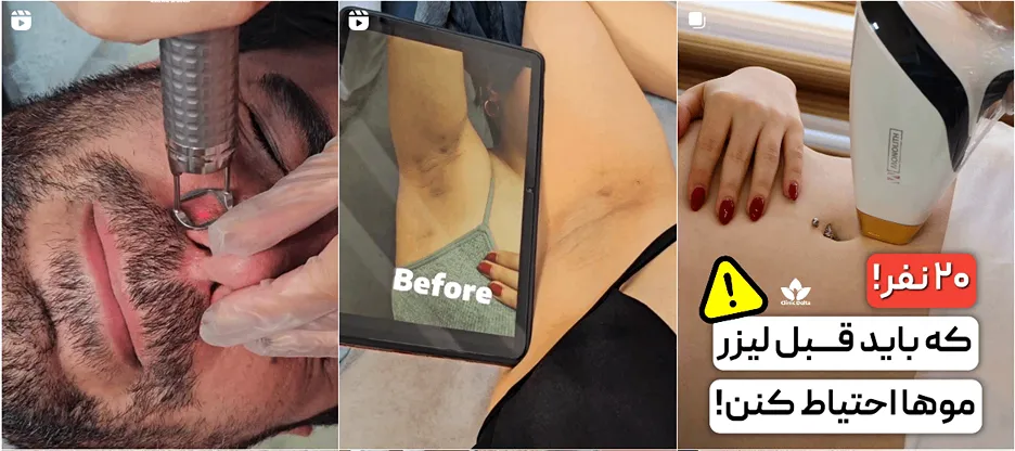 نمونه کار یکی از بهترین مرکز لیزر تهران را مشاهده میفرمایید.