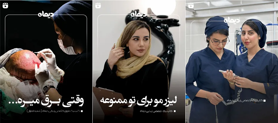 لیزر در کرمانشاه در کلینیک دیماه کاملا قابل انجام است