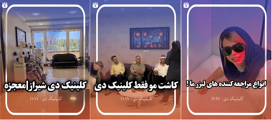 نمونه کار کلینیک زیبایی دی را میتوانید در این تصویر مشاهده بفرمایید.