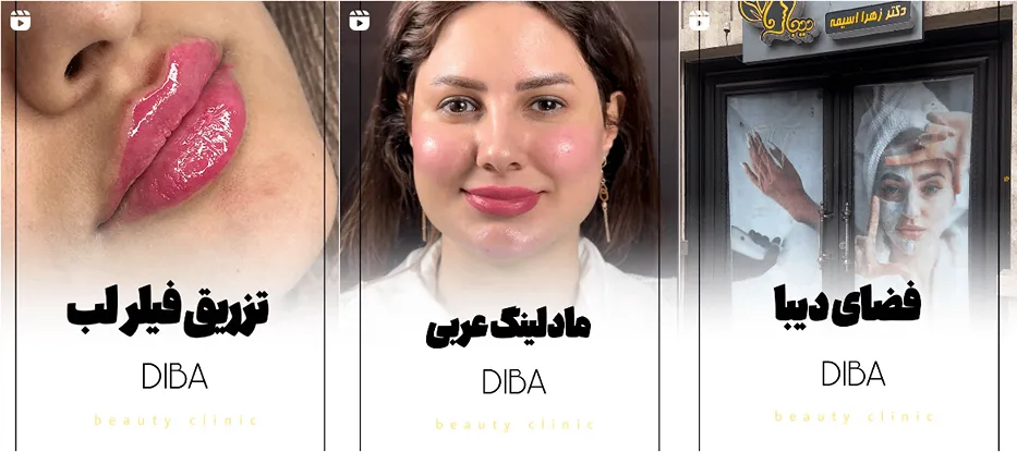 نمونه کار یکی از مدرن ترین کلینیک لیزر کرمانشاه را مشاهده میفرمایید.