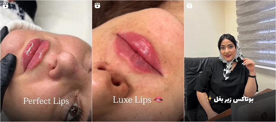 نمونه کار یکی از بهترین کلینیک زیبایی خرم آباد را مشاهده میفرمایید.